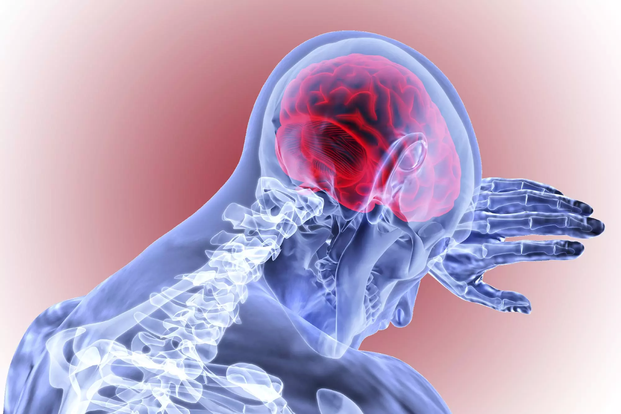 Thiếu máu não: Dấu hiệu điển hình và cách tăng tuần hoàn não